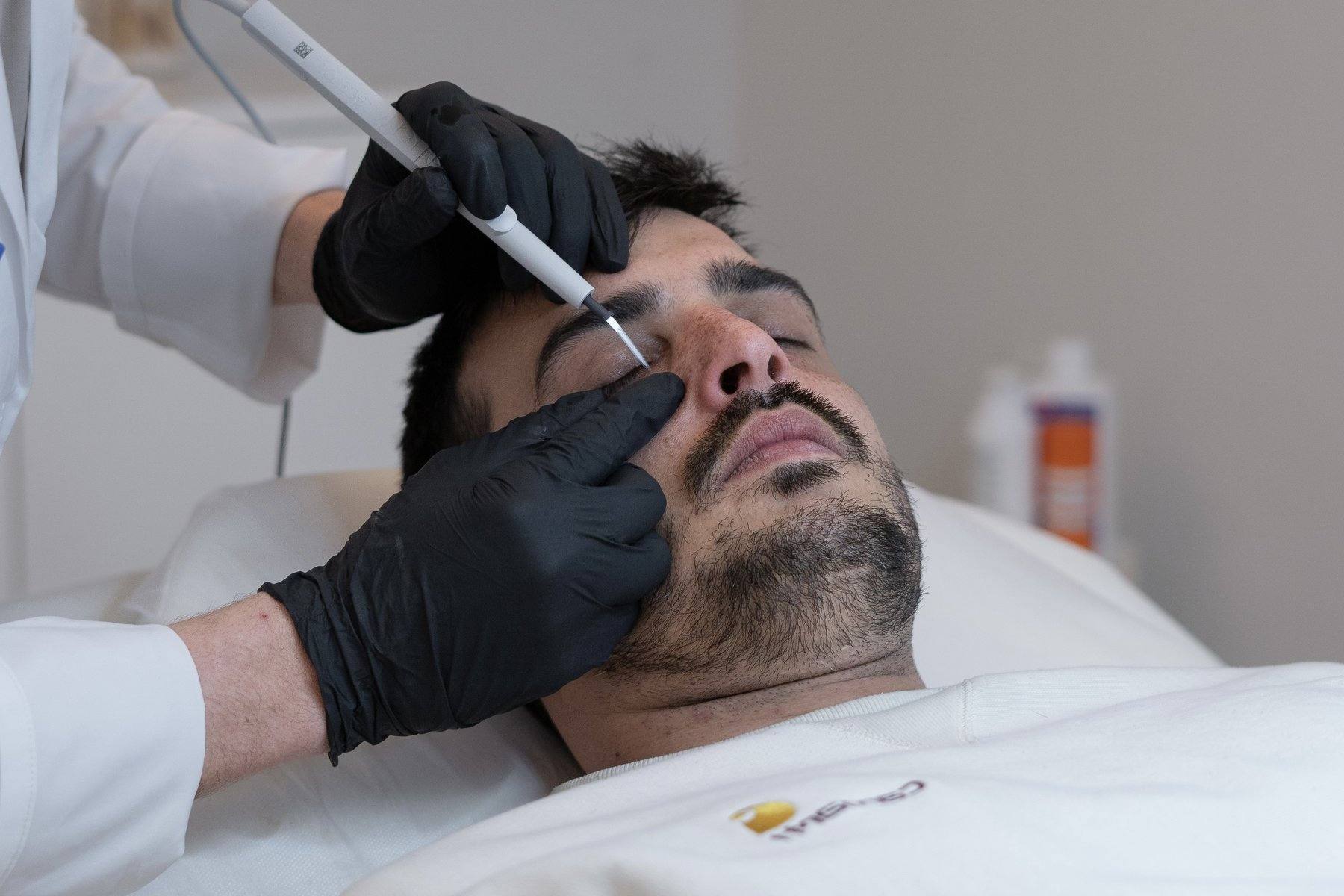 benign-lesion-removal