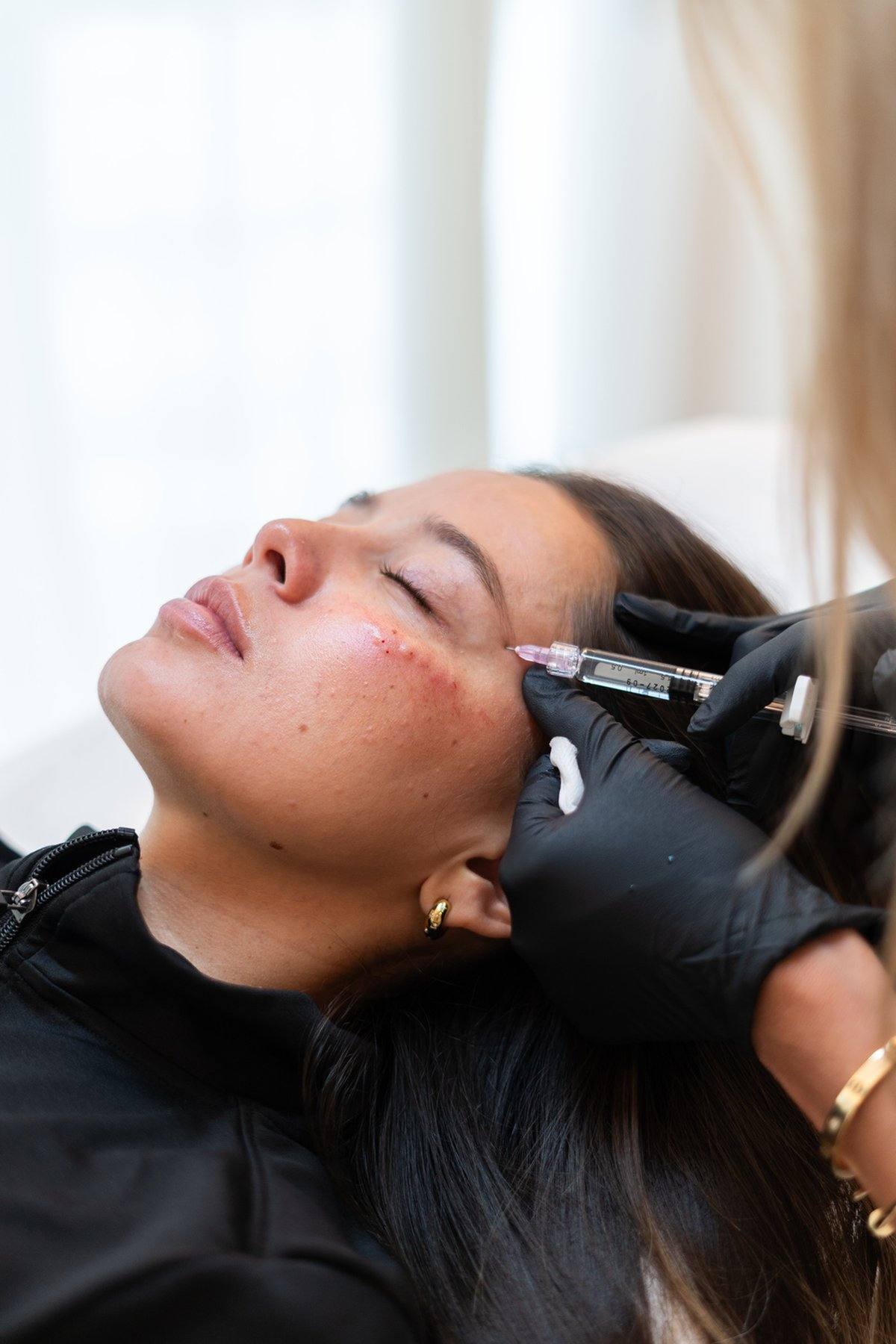 polynucleotides-facial