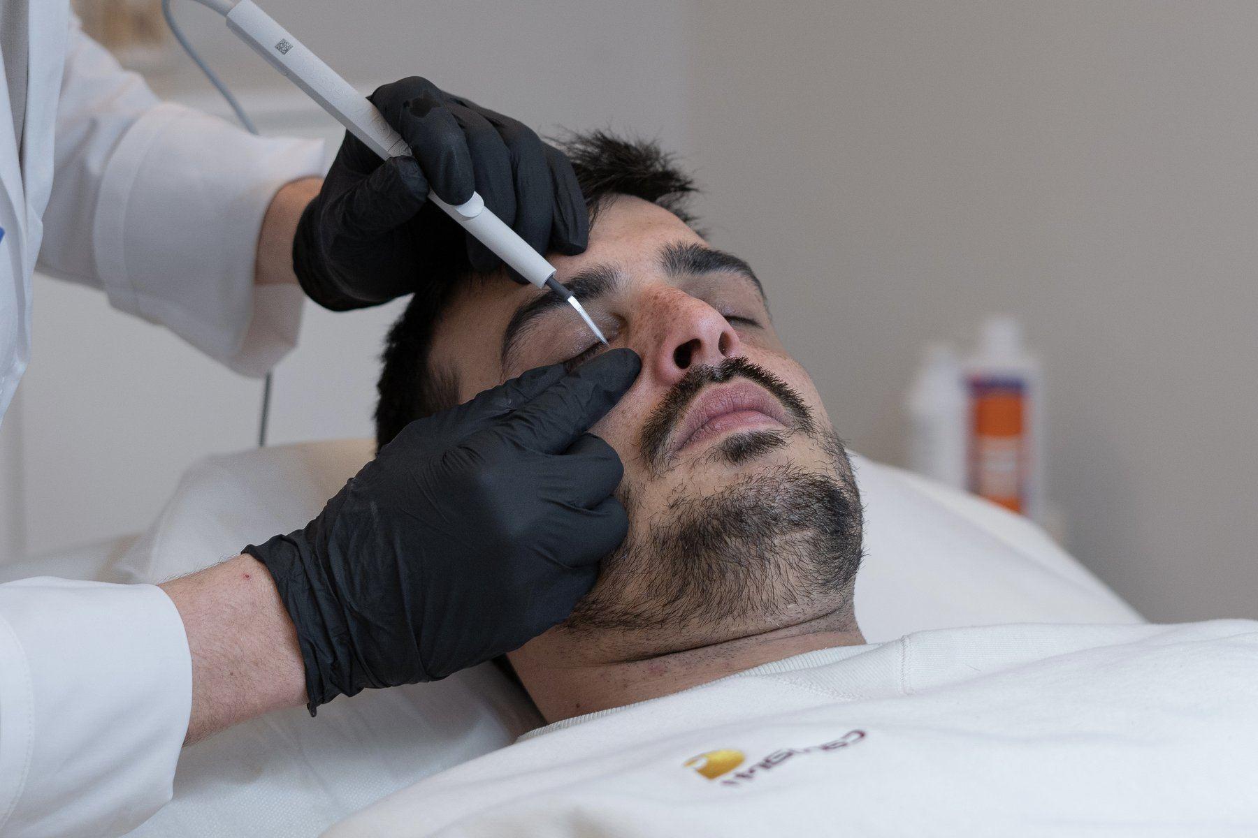 benign-lesion-removal-home