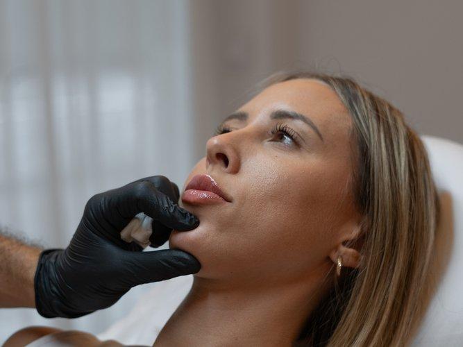 chin-section-1