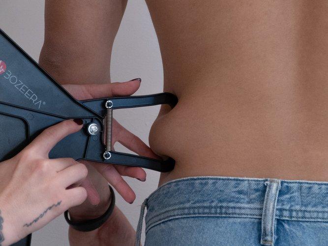 criolipolisis-section-1