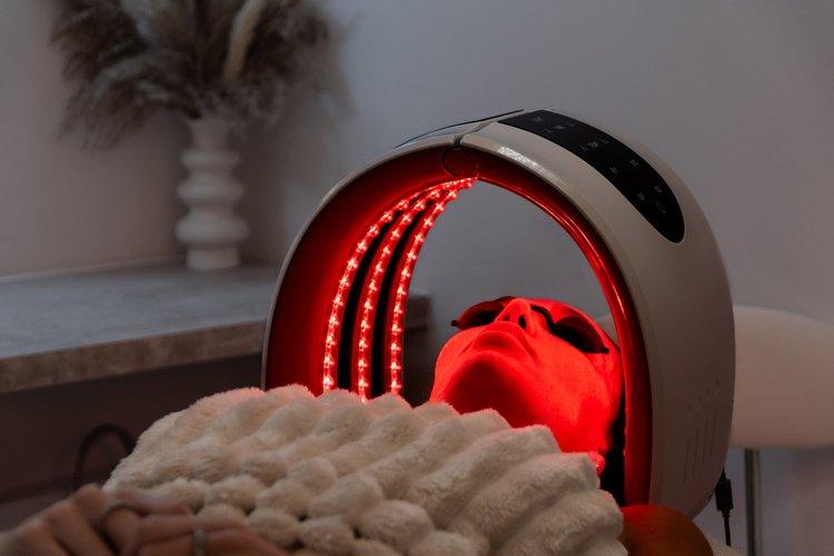 exosomes-microneedling-face-section-3