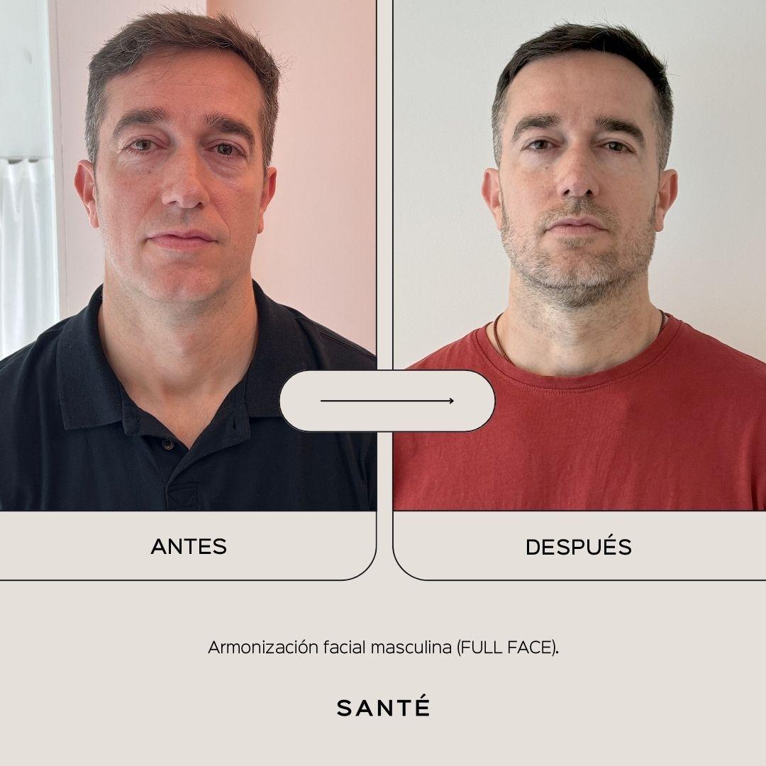 full-face-media-1