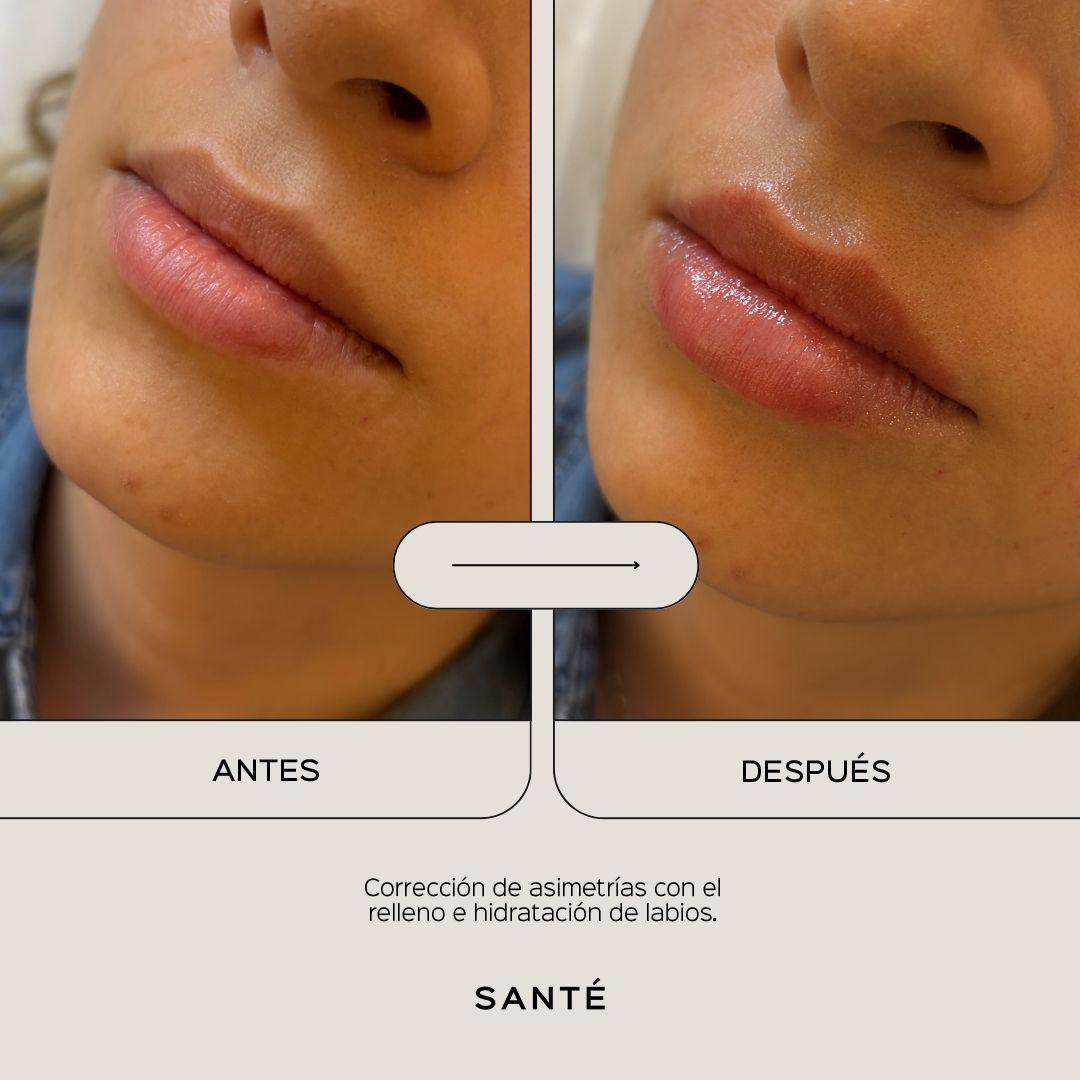 full-face-media-4
