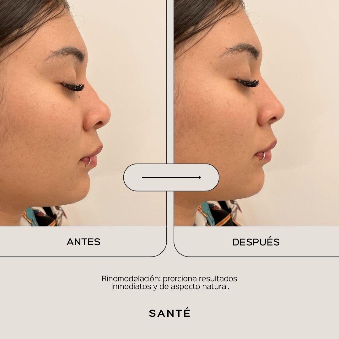 full-face-media-5