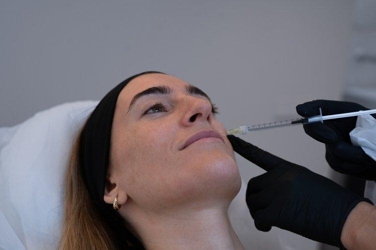 gummy-smile-section-2