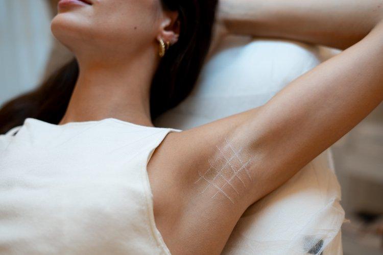 hiperhidrosis-section-3