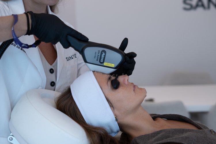 laser-acne-section-2