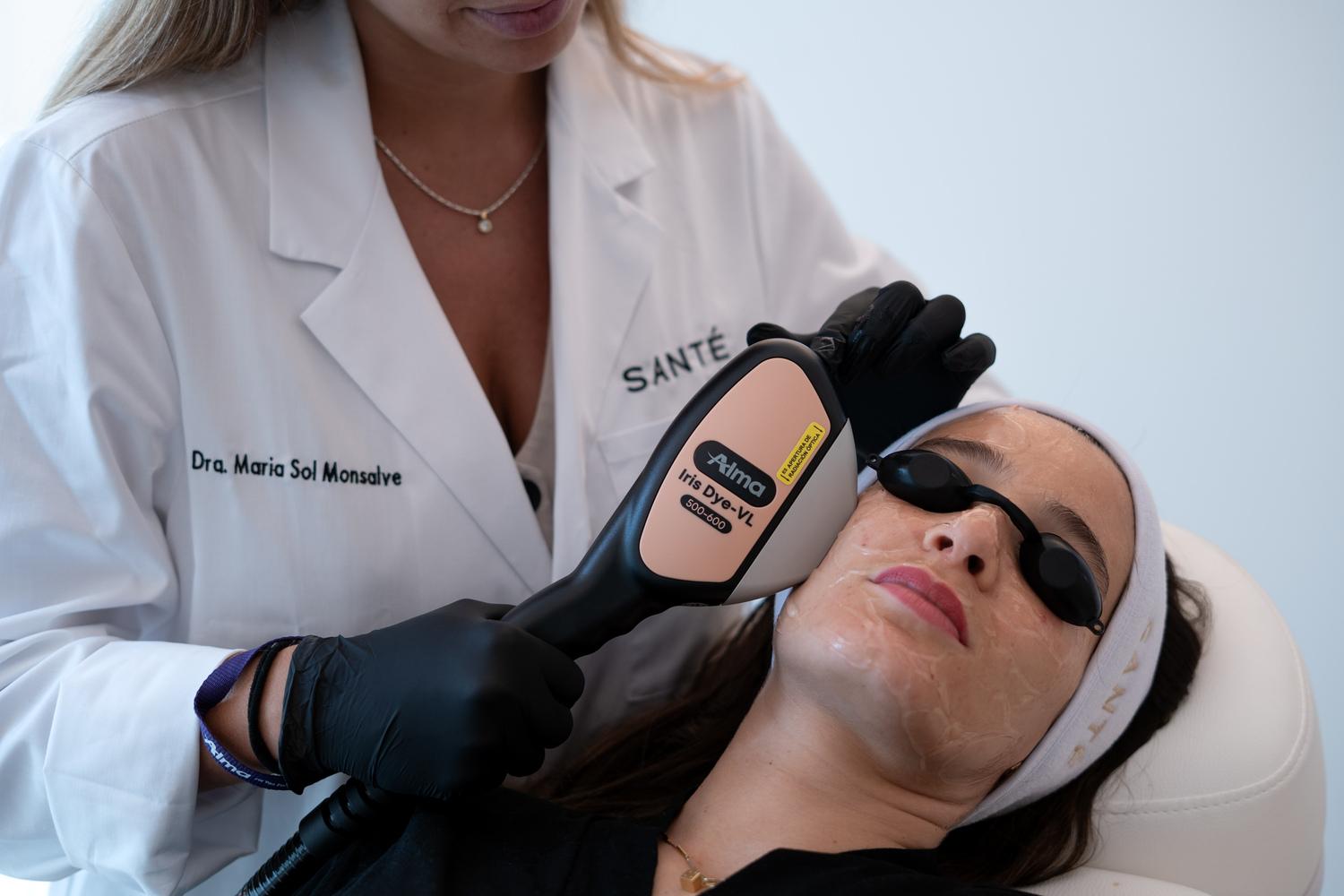 laser-rosacea