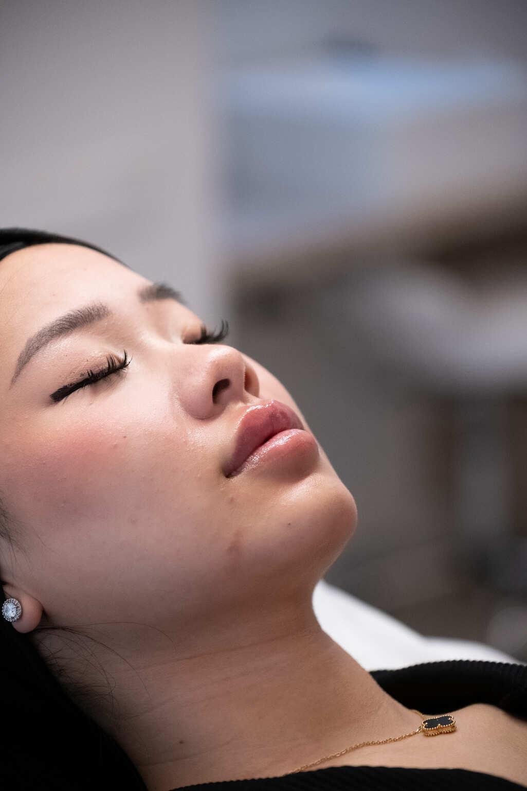 lip-filling-and-hydration