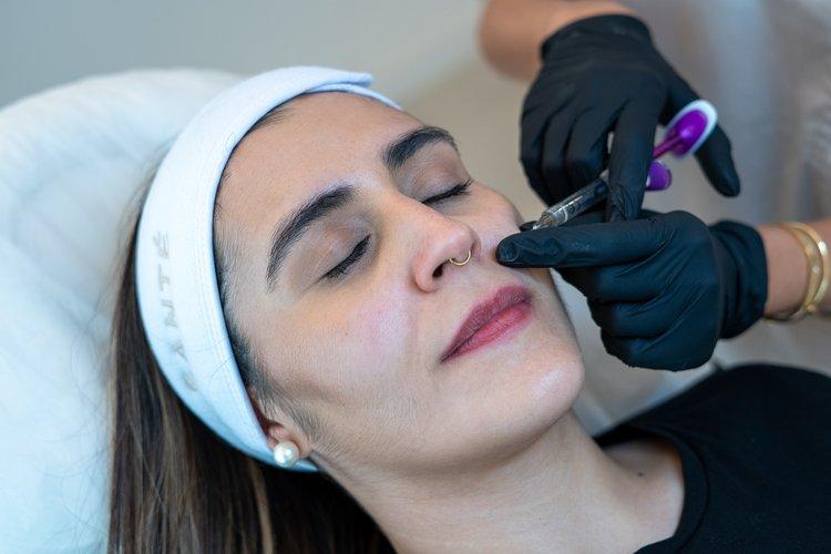 nasolabial-fold-section-3