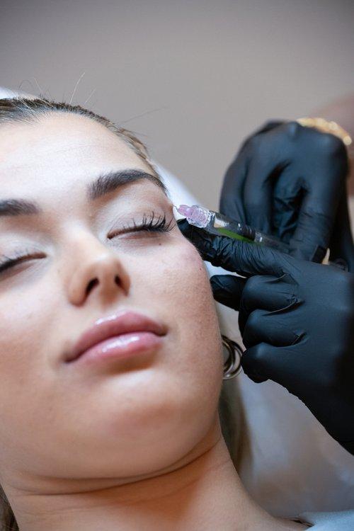 polynucleotides-dark-circles-section-2