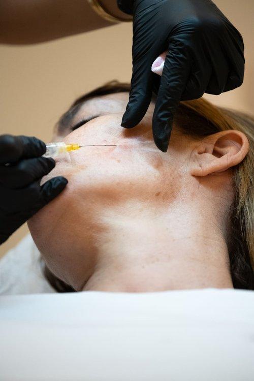 sculptra-section-1