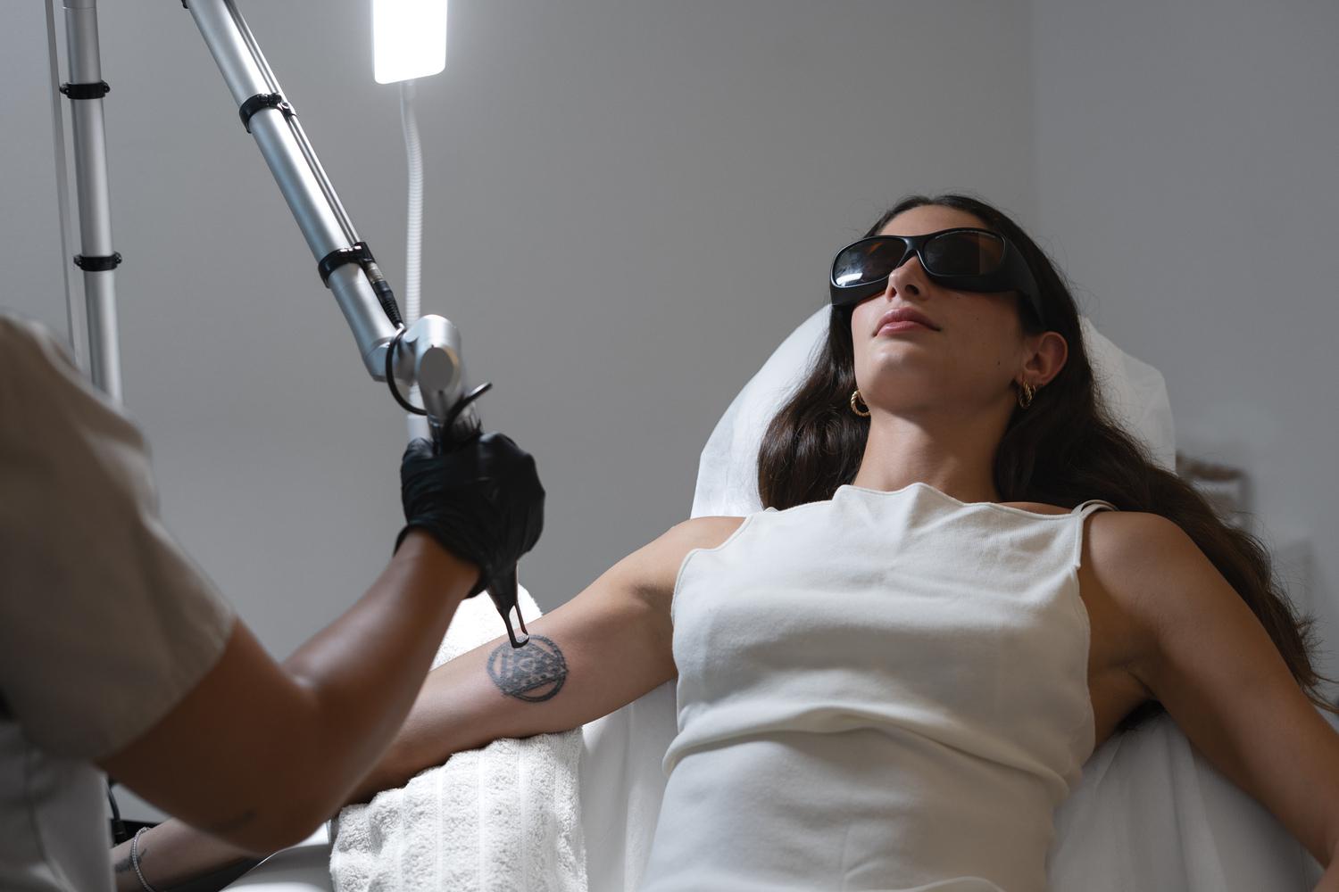 tattoo-removal