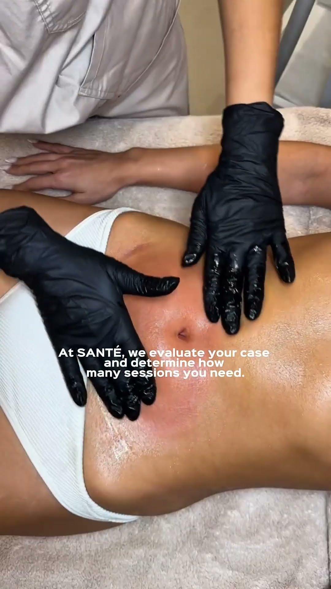 Santé Clínica Estética Barcelona