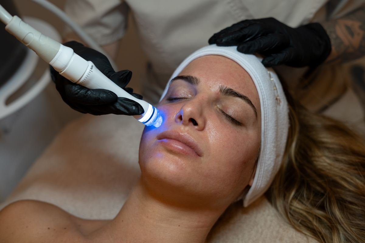 acne-control-section-2