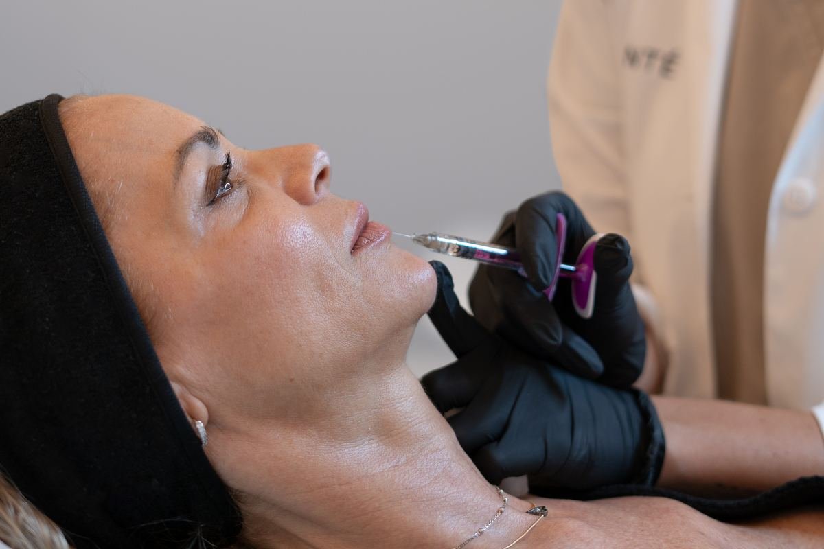 armonizacion-facial-femenina-madura-section-2