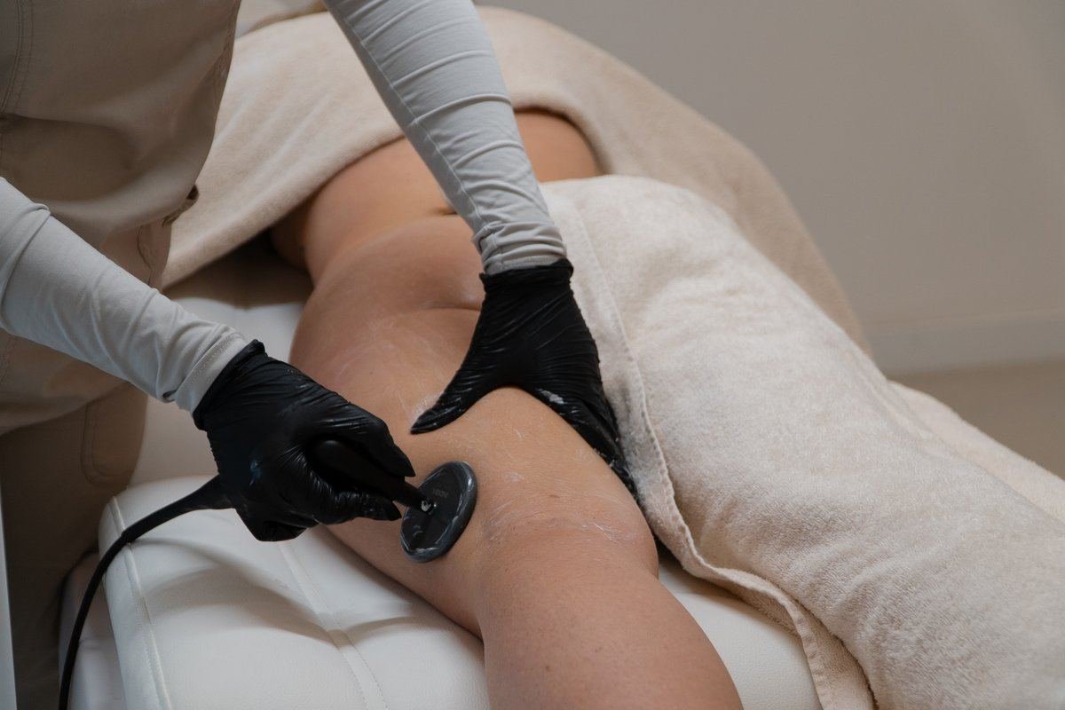 cellulite-subcision-section-3