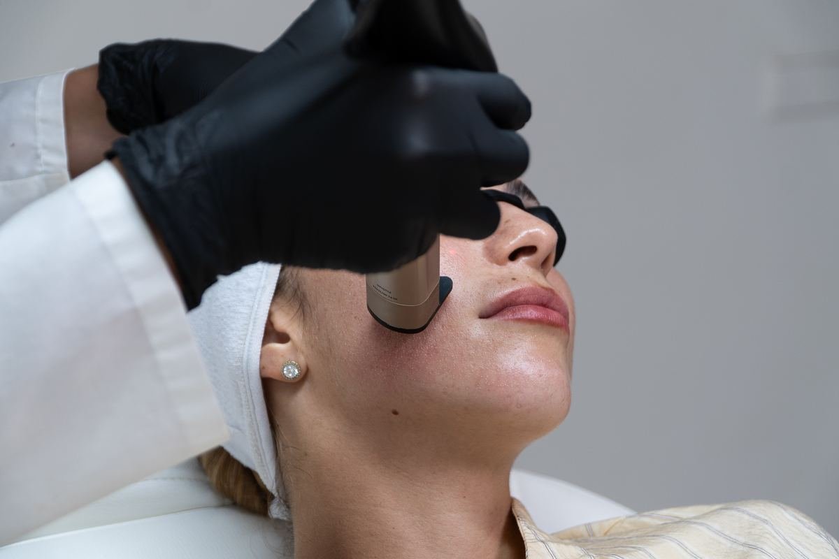 collagen-laser-1570-facial-section-2