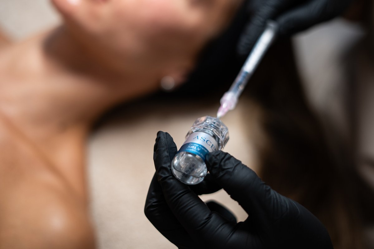 exosomes-microneedling-face-section-1