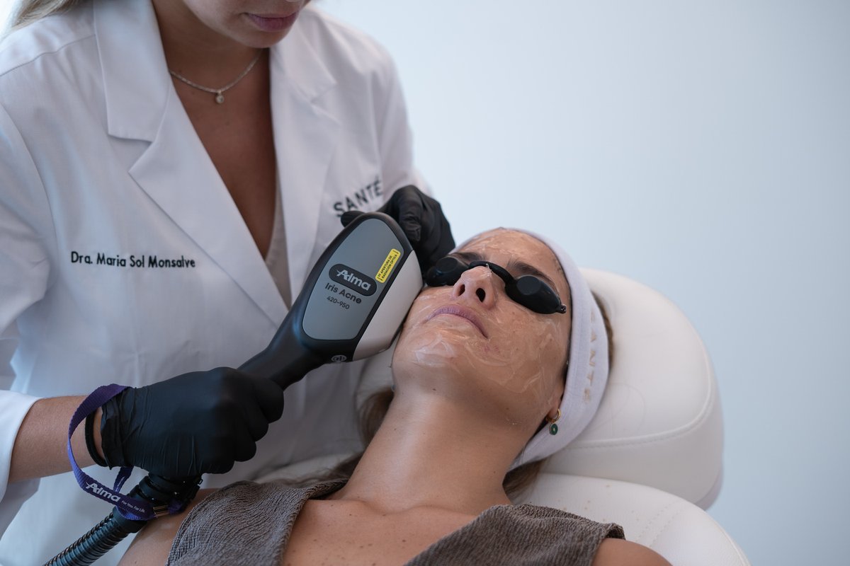 laser-acne-section-1