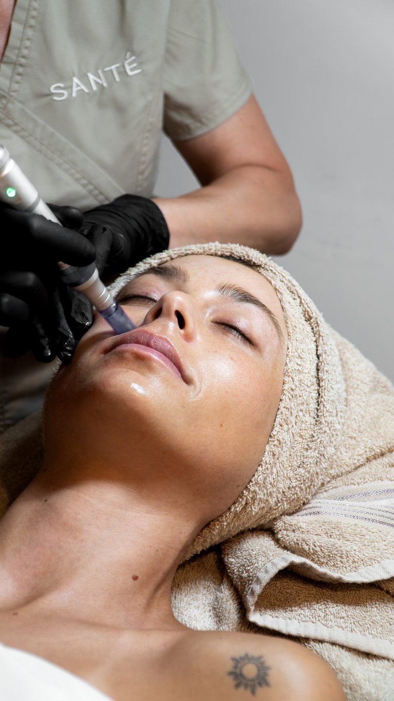 microneedling-section-1