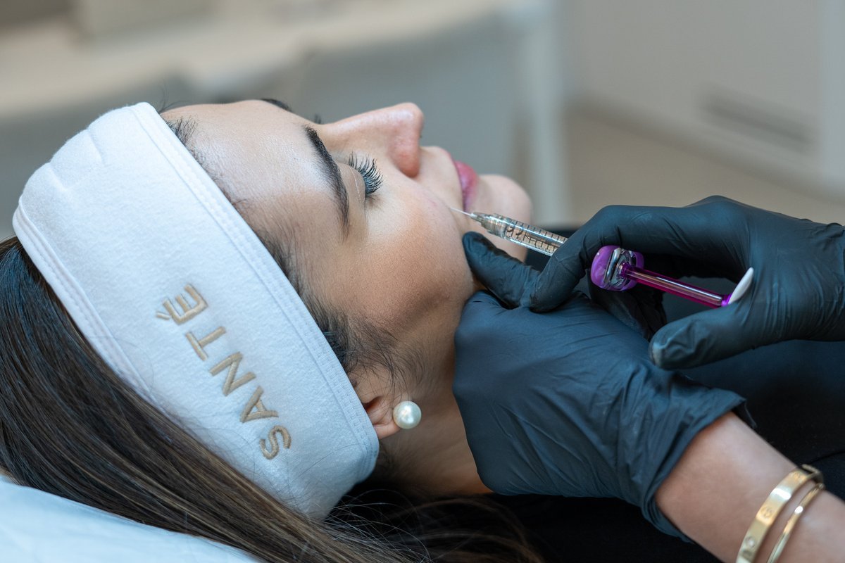 nasolabial-fold-section-2