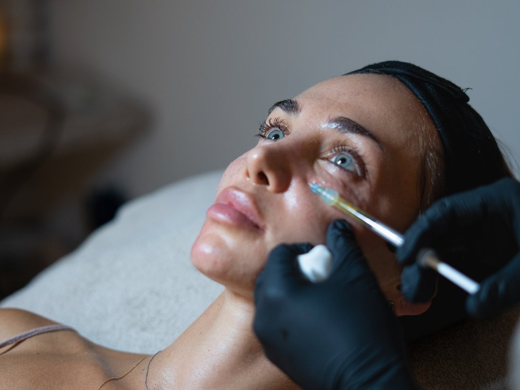 prf-injectable-facial-section-1