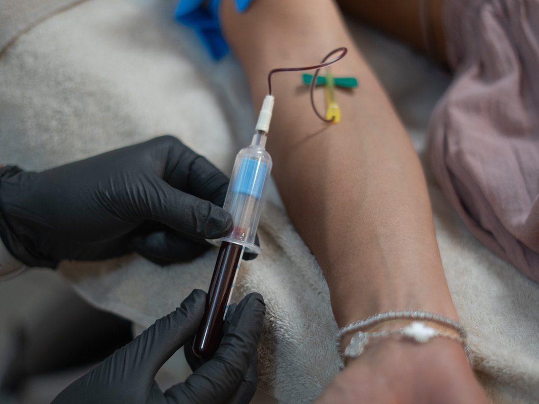 prf-injectable-facial-section-3