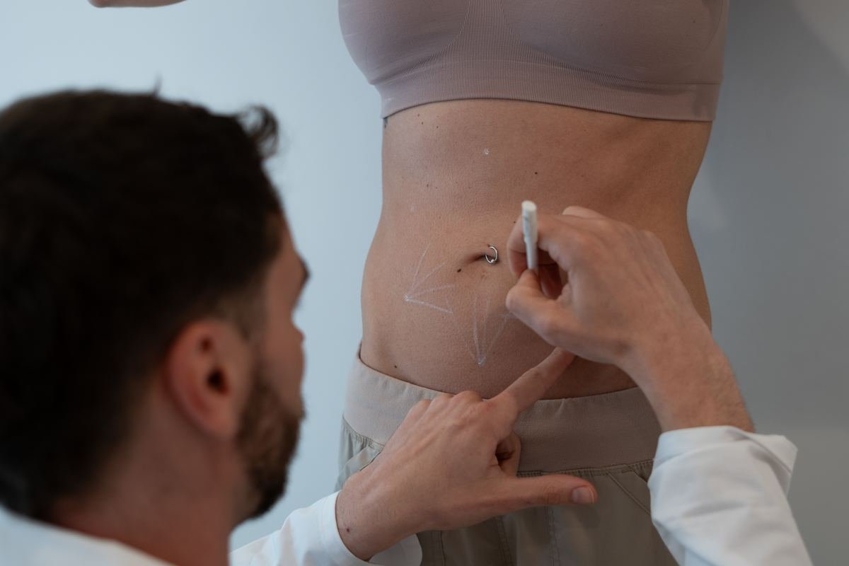 sculptra-abdomen-section-1