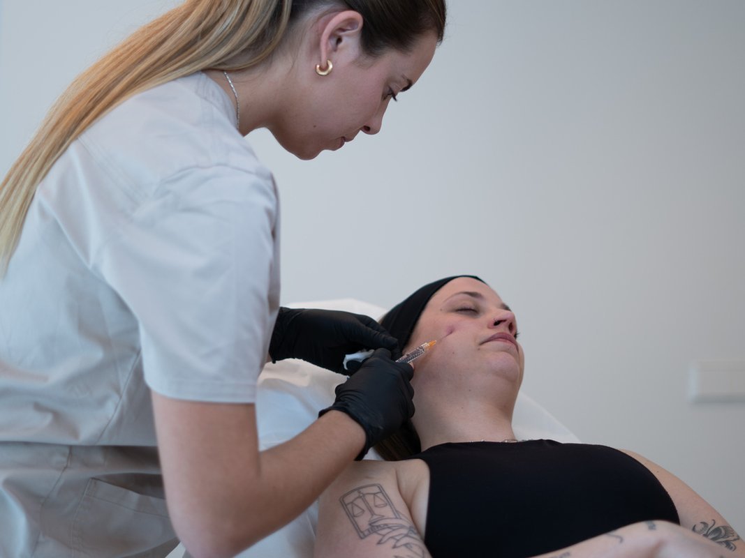 under-eye-filler-section-1