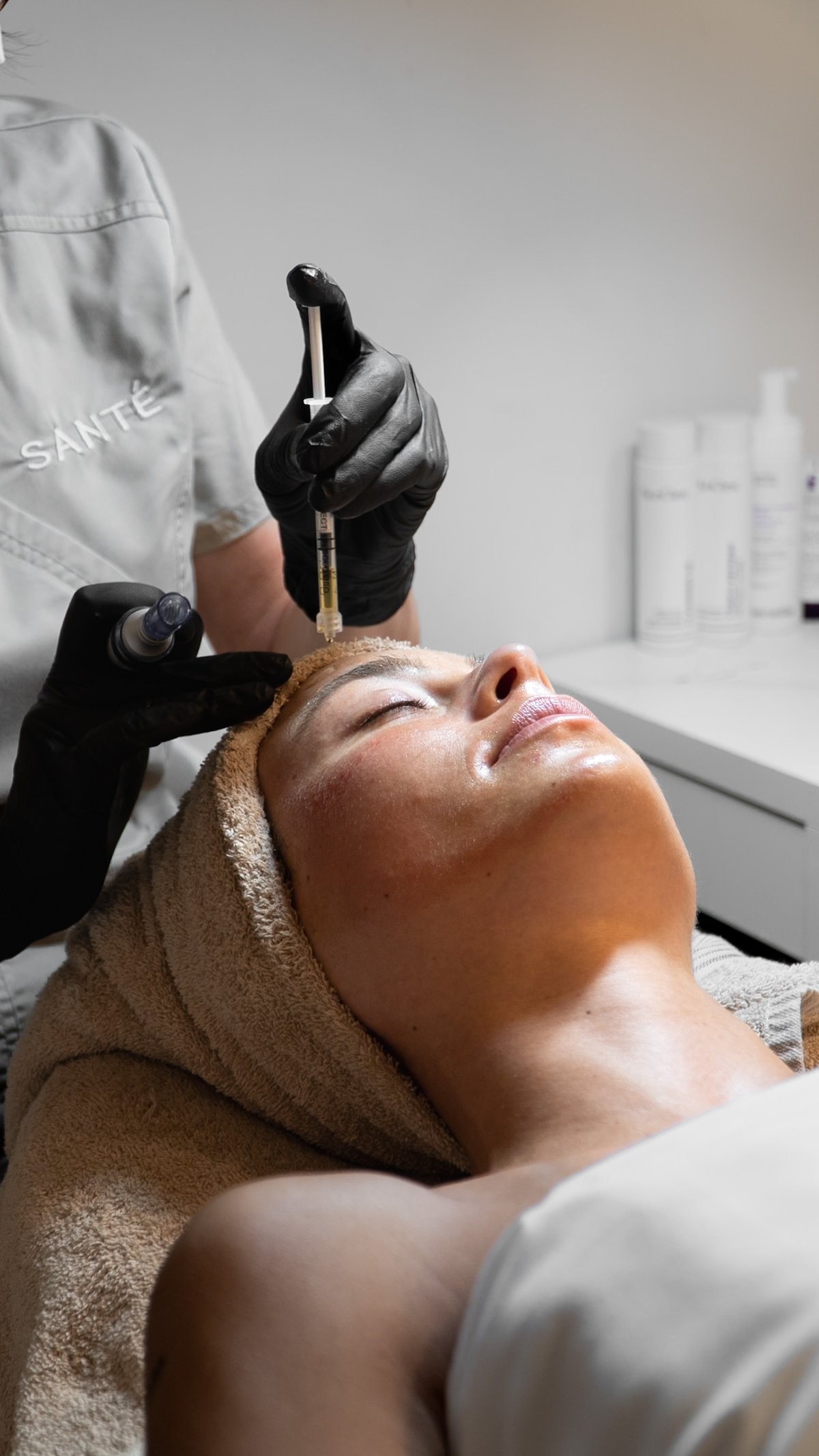 microneedling