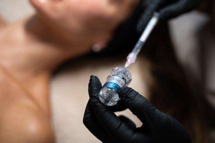 exosomes-microneedling-face-section-1