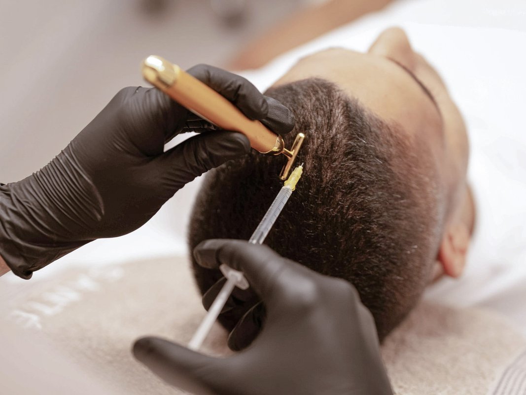 hair-loss-medication-section-1