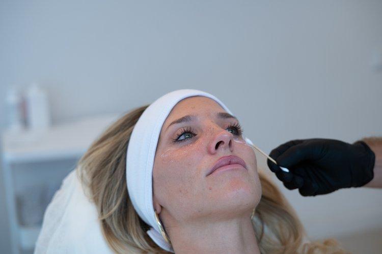 periocular-mesotherapy-section-1