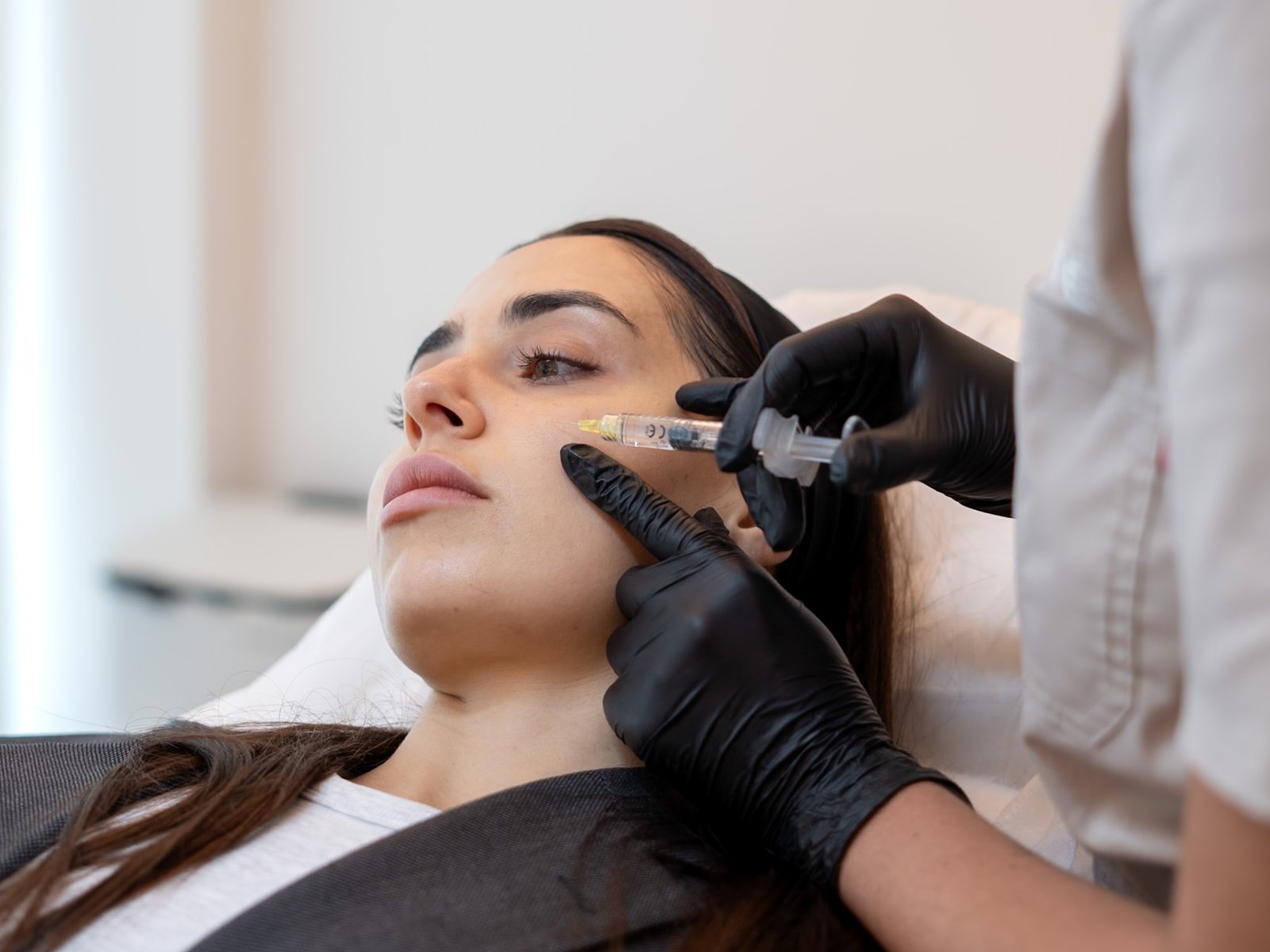 Cheekbone Filler with Hyaluronic Acid